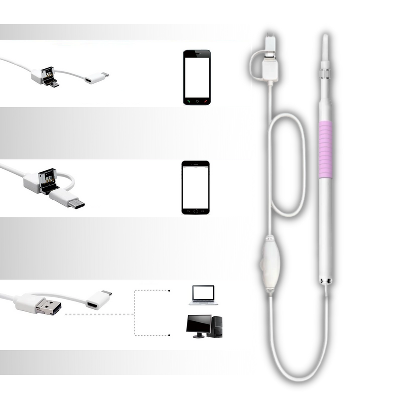 3 in 1 Ear Camera