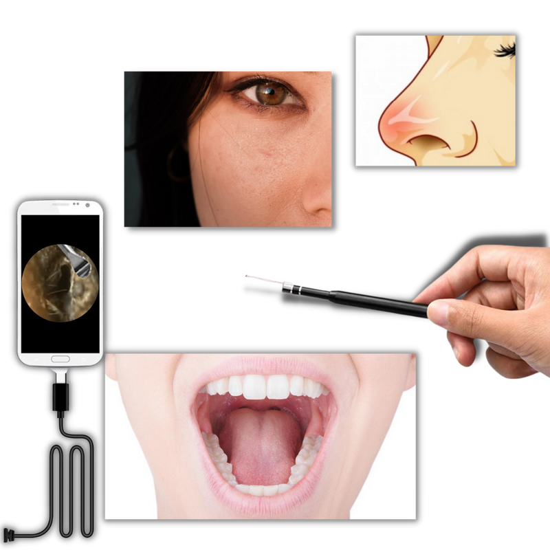 3 in 1 Ear Camera