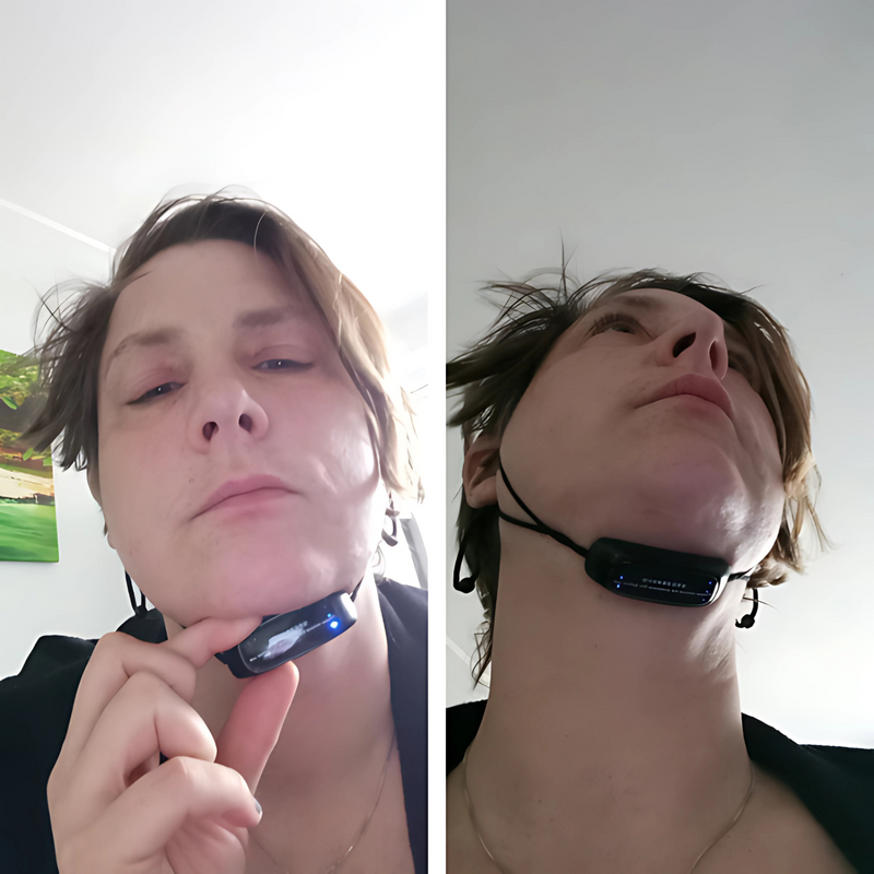 FaceLift™ – Reduce Double Chin, Lift Your Look