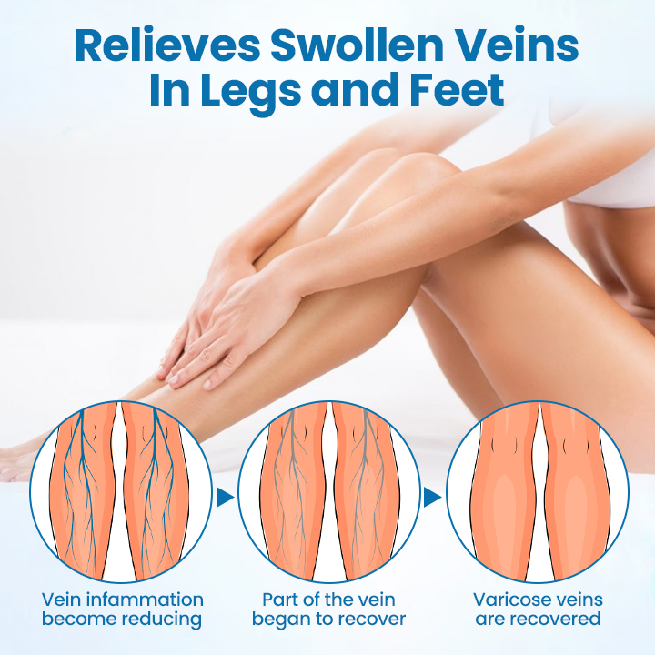 Timilk® VeinGuard Herbal Spray 🔥