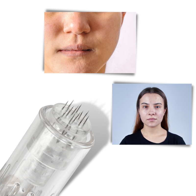 Dermal Microneedling Pen