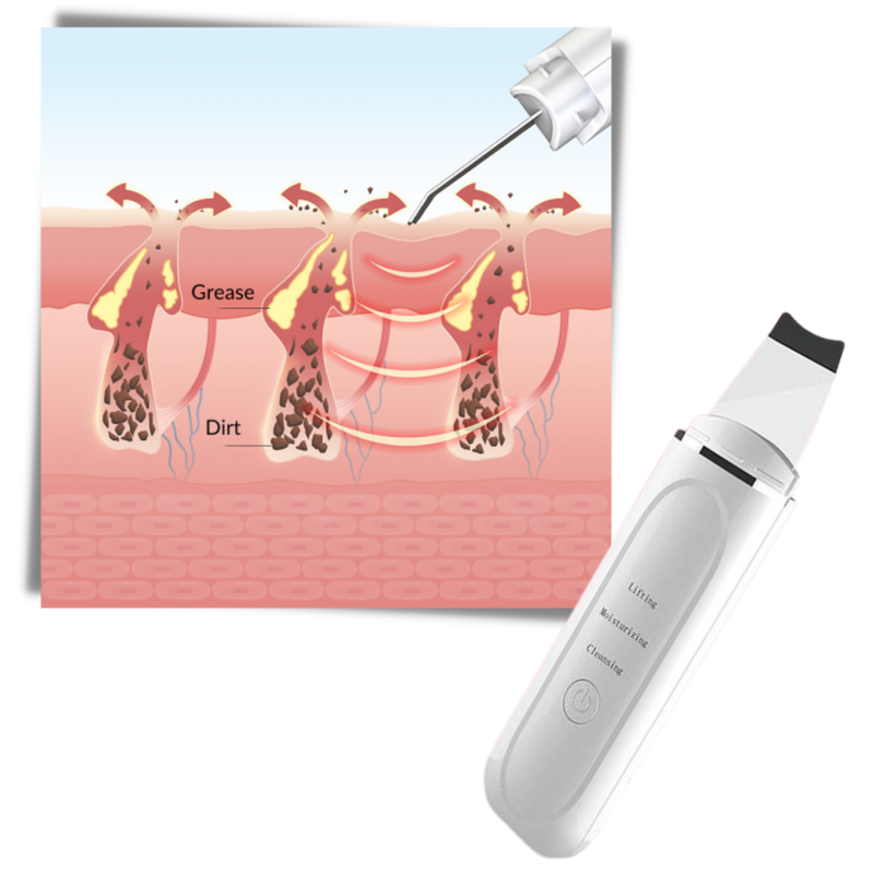 Ultrasonic deep cleansing facial scrubber