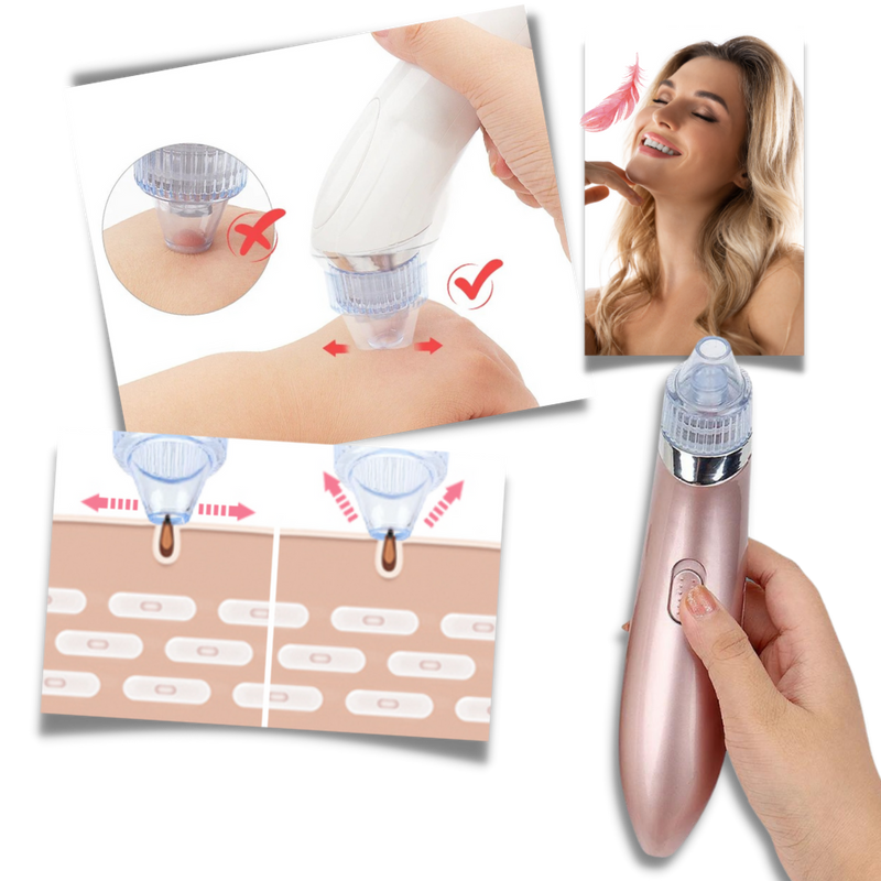 Facial Blackhead Remover Set