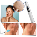 Dark Spot Remover Blue Laser Pen