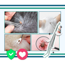 Precision Tick Extractor