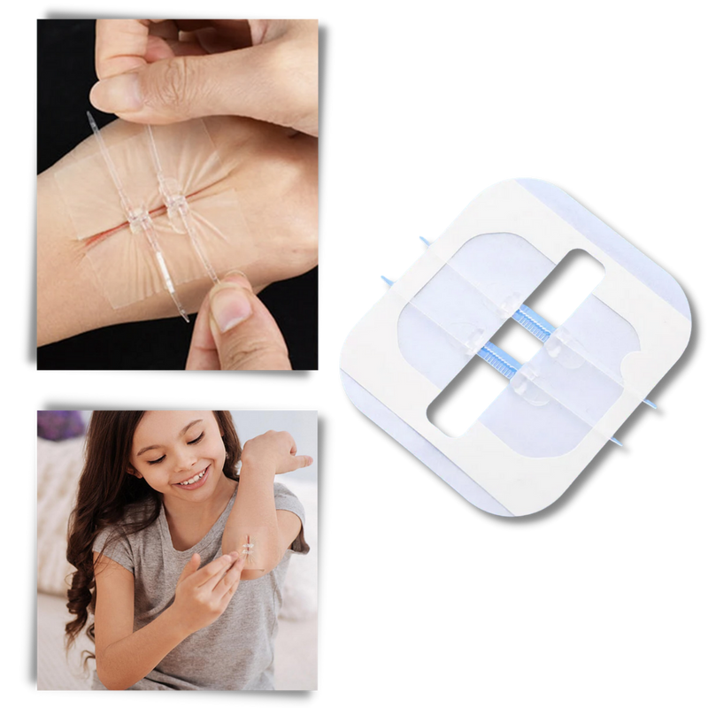 Water-proof wound adhesive