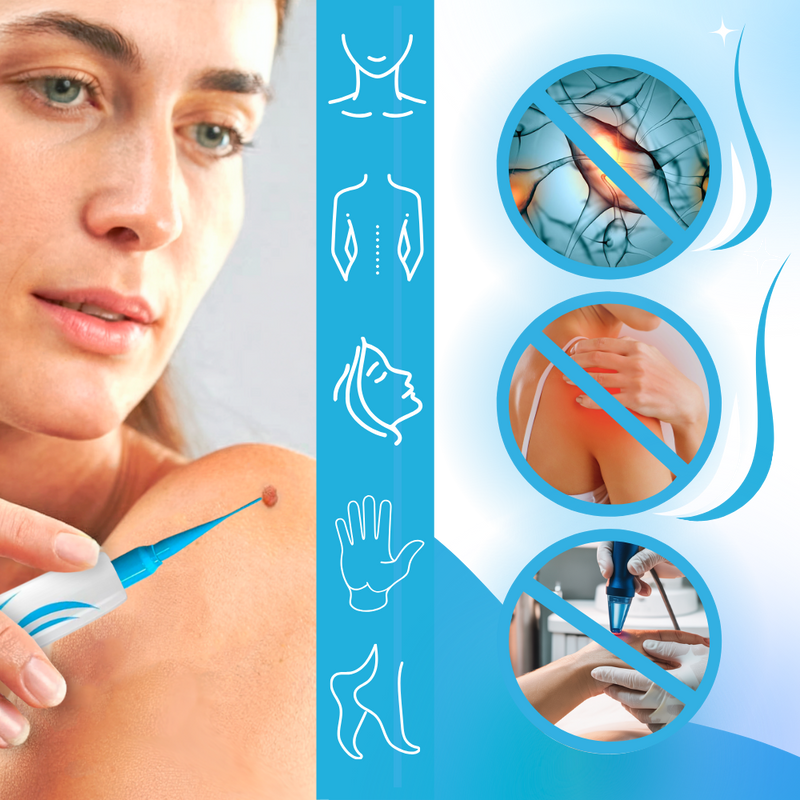 Skin Tag Removal Pro