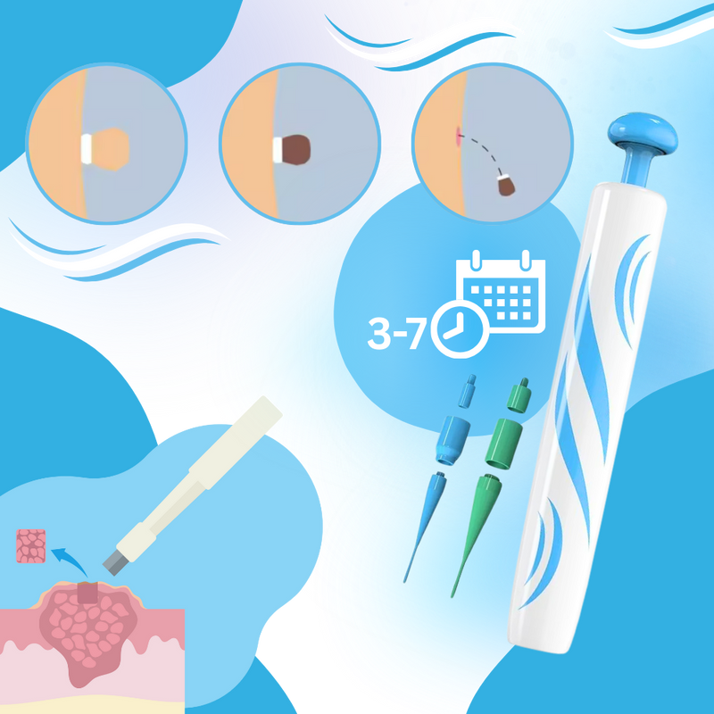 Skin Tag Removal Pro