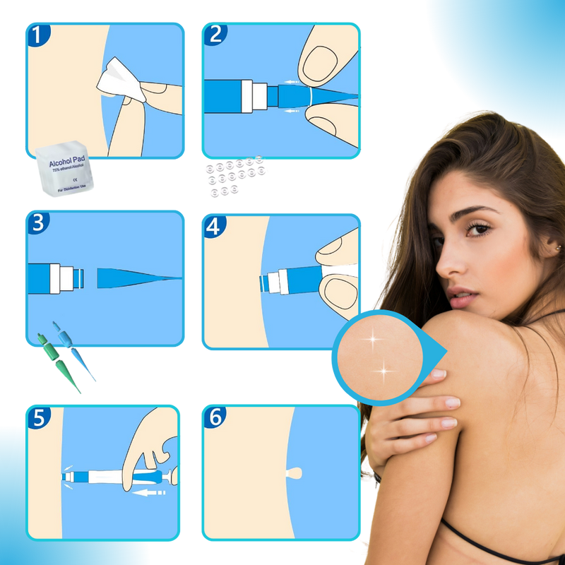Skin Tag Removal Pro