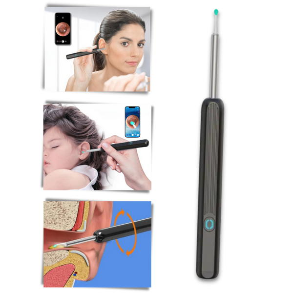 Smart Ear Wax Removal Camera