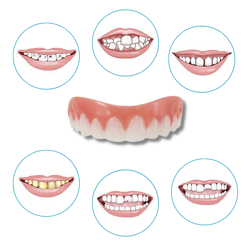 Snap-On Veneer Teeth