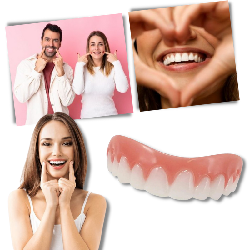 Snap-On Veneer Teeth